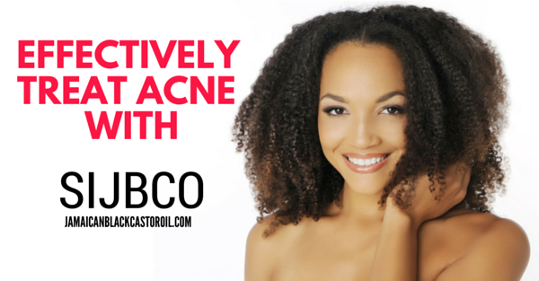 Si Jamaican Black Castor Oil Effectively Treats Acne